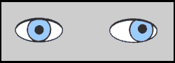 Diagram of a person with Exotropia, often called 'wall-eye'