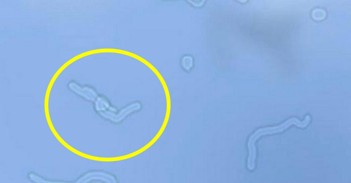 Corps flottants et éclairs de lumière ou éblouissements intermittents